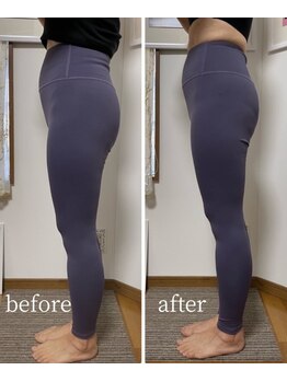 ベレミアム(Bellemium)/骨盤ケアで下半身痩せ