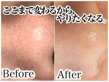 エヌツービューティー(N2 BEAUTY)