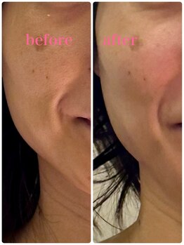 リセス(Recess)/完全無添加だから結果が確実!