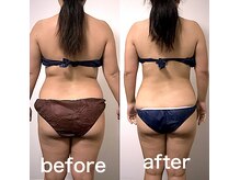 エステサロンクオーツ