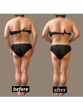 ベオ(Salon Beo)/下半身モニター様