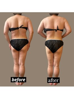 ベオ(Salon Beo)/下半身モニター様