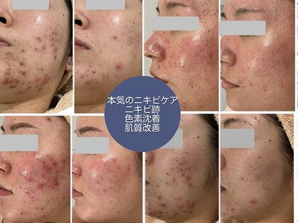 エメ 心斎橋(Aimer)の写真