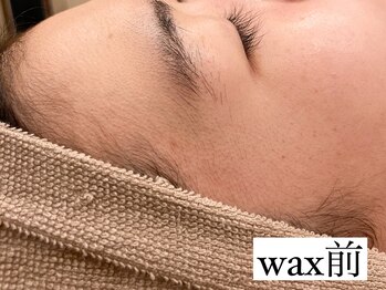 サロン ド ワカ(Salon de WAKA)/フェイシャルwax初回 施術前
