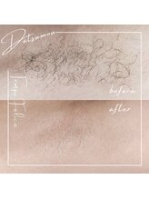 テンポフェリーチェ 浜松店(Tempo Felice)/浜松脱毛/都度払い/メンズ脱毛