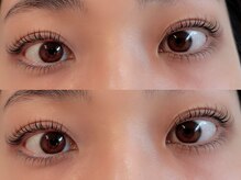 ユーロ(EURO)/ラッシュリフト上下・まつパ