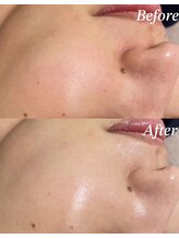 モーヴ 藤沢(MAUVE)/施術風景