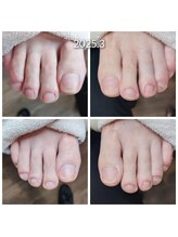 爪切り屋 足楽/