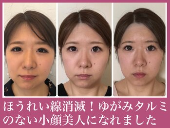 アクアビー(AQUA-B)/