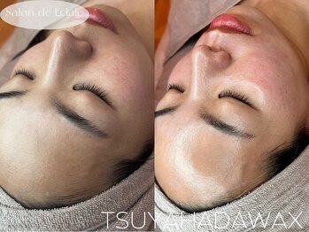 サロンドエクラル(Salon de Eclale wax)/一度受けると虜になる艶肌wax♪