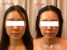 ビーキュート 神戸元町店(BE-CUTE)/コルギ1回