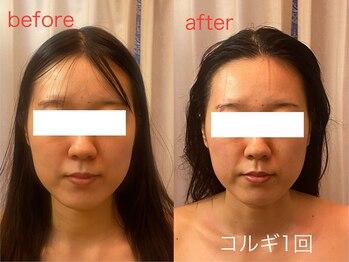 ビーキュート 神戸元町店(BE-CUTE)/コルギ1回