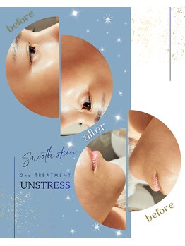 ハレル(Hareru)/Before…After(5)　UNSTRESS