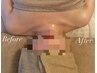 【首肩凝り深部から、整える】巻き肩、頭痛、眠りの浅い方に特化★50分