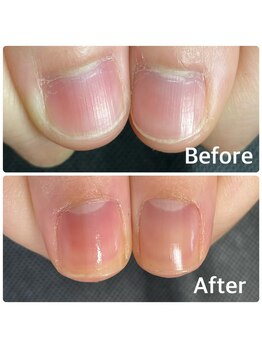 ルームイチマルイチネイルズ(Room101Nails.)/自爪育成・最強のネイルケア鳥取
