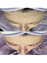 マリーブ 恵比寿本店(MAREVE)/マリムーブフェイシャルワックス