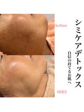 ビューティーサロン ラグジューム(Beauty salon Laxum)/