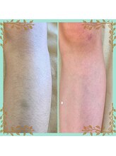 ネクサス(NEXUS)/脚もスッキリ見えて服が楽しめる