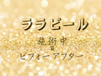 CDF 赤坂/ララピール