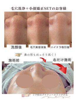 頭のオアシすぱ/小顔矯正 1