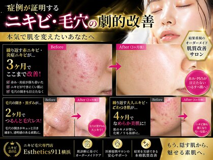 エステティックス ナインワンワン 横浜(Esthetics911) の写真