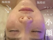 ハクカスパ(HAKUKA SPA)
