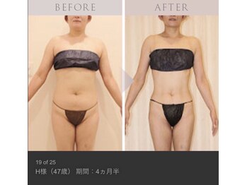 ジェニックサロン グランドギンザ ひたちなか(GENIC SALON GRAND GINZA)/フェリーチェの痩身プログラム