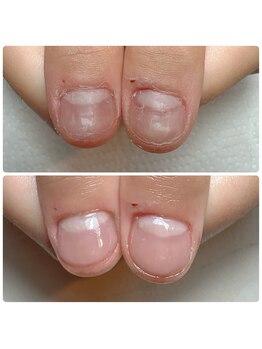 カサカサケアも付いてます