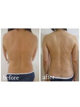 加圧ビューティーサロン スタイル エム(beauty salon style M)/50代/加圧×痩身リンパ120分