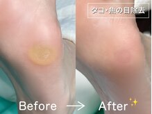 ディオフット(DIO FOOT)/違和感なく歩ける足へ！