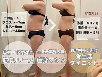 ミルズ 天神店(MillS)/ダイエットビフォーアフター