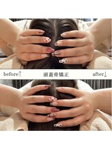 アースコアフュールボーテ 佐野新都市店(EARTH coiffure beaute)/【頭蓋骨矯正】Before/After 