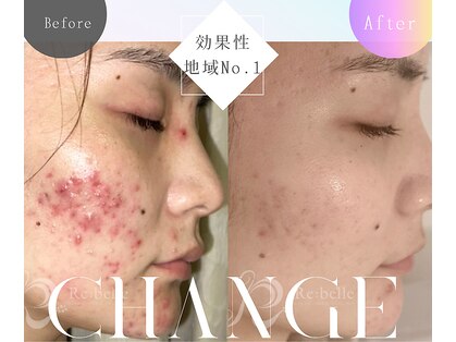 ミーシェ(Meshie)の写真