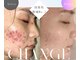 ミーシェ(Meshie)の写真