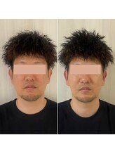 サロン ウェル(SALON WELL)/【30代 小顔矯正/リフトアップ】