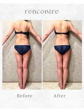 ランコント(rencontre)/肩こり/リンパ/ヘッドスパ/痩身