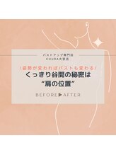 チュラ 大宮店(Chura)/肩位置激変→谷間も激変（1/4）
