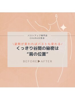 チュラ 大宮店(Chura)/肩位置激変→谷間も激変(1/4)