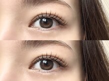 イルム ビューティー アンド ライフ(iLM beauty and life)