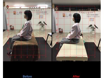 ストレチックス 近江八幡店/姿勢改善ビフォーアフター1回