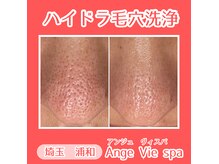 アンジュ ヴィスパ(Ange Vie Spa)の雰囲気（皮脂詰まり・黒ずみ・ざらつき…全て毛穴トラブルに◎）