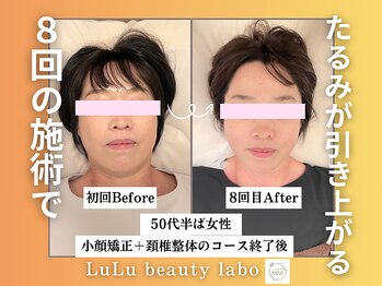ルルラボ(LuLu beauty labo)の写真/【美容整体＆小顔矯正￥9,800】ほうれい線・たるみを改善して若々しいフェイスラインへ◎
