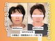 ルルラボ(LuLu beauty labo)の写真/【美容整体＆小顔矯正￥9,800】ほうれい線・たるみを改善して若々しいフェイスラインへ◎
