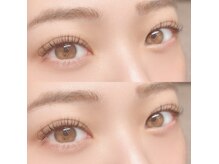 フーフロー(Fooflow)/フラットラッシュ100本