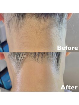 アロー(Allo!)/後ろ姿も綺麗です◎