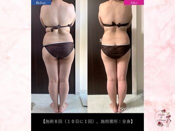 サロンドモアロ(Salon de Moaro)/Before/After