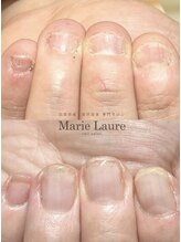 マリーロール 天王寺店(Marie Laure)/自爪育成/深爪矯正/ネイルケア