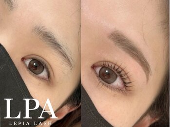 レピア 仙台店/韓国式LEPIA Before&Aｆter