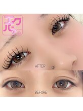 ヴィヴィ(vivi)/エクパーマ