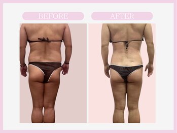 スリムライン 八戸店(The Slim Line)/before→after